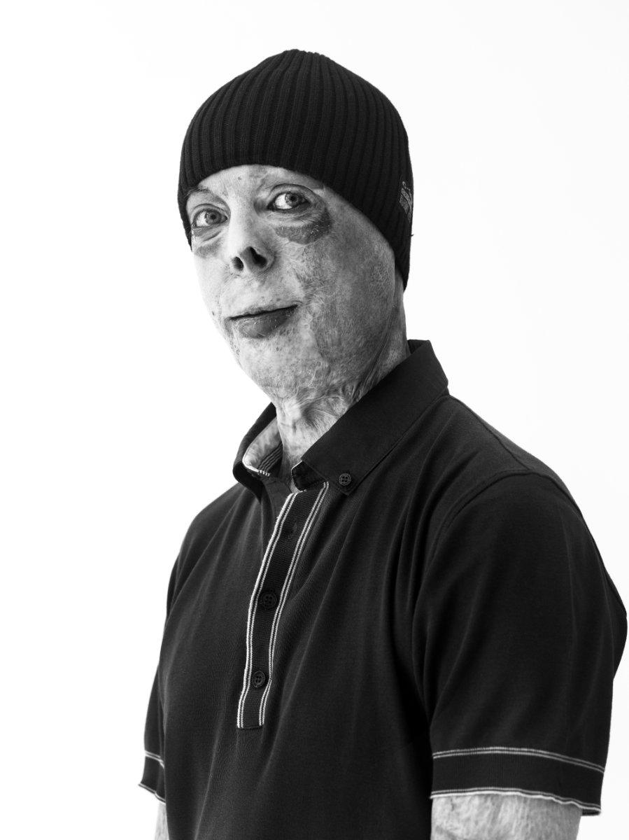 MARTYN-COMPTON